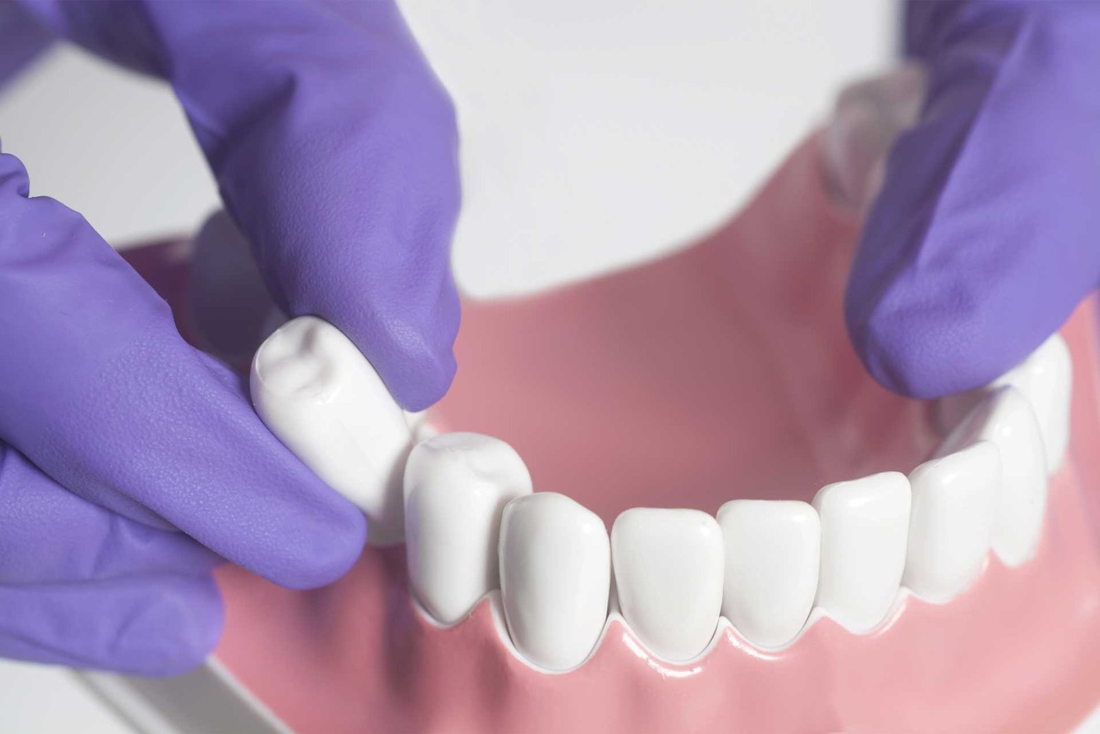 dental extraction demostrate