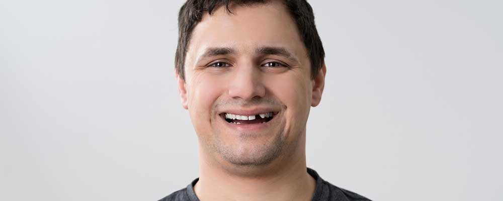 tooth lose man smiling