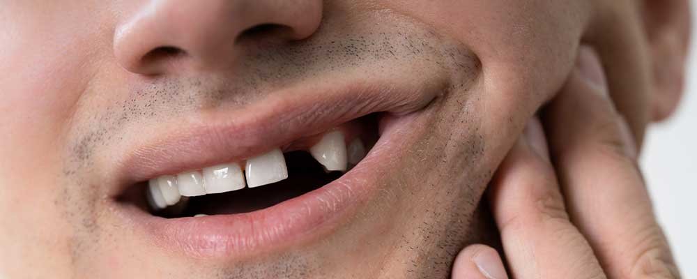 tooth missing closed image